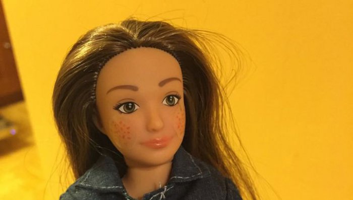 В США создали "конкурентку" Барби с прыщами и целлюлитом