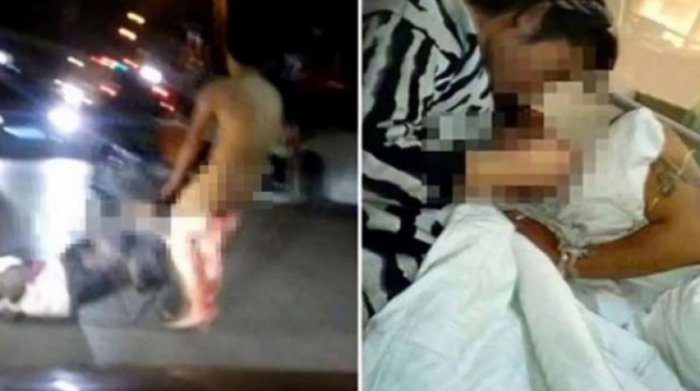 Жена дважды отрубала пенис мужу-изменнику