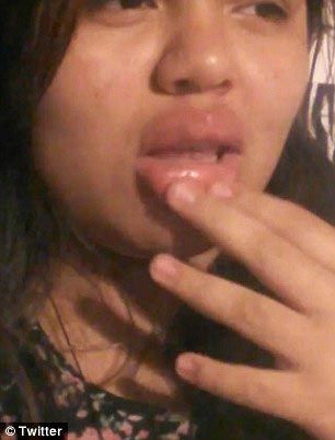 Подростки накачивают губы бутылками и стаканами