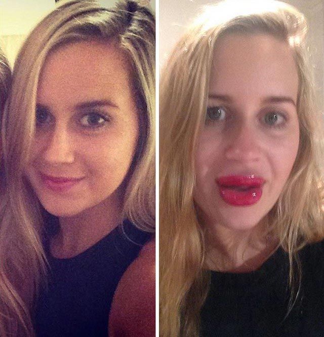 Подростки накачивают губы бутылками и стаканами