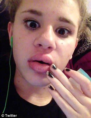 Подростки накачивают губы бутылками и стаканами