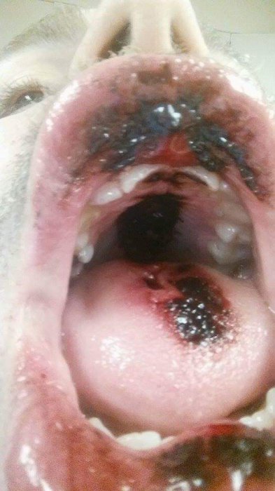 О вреде электронных сигарет