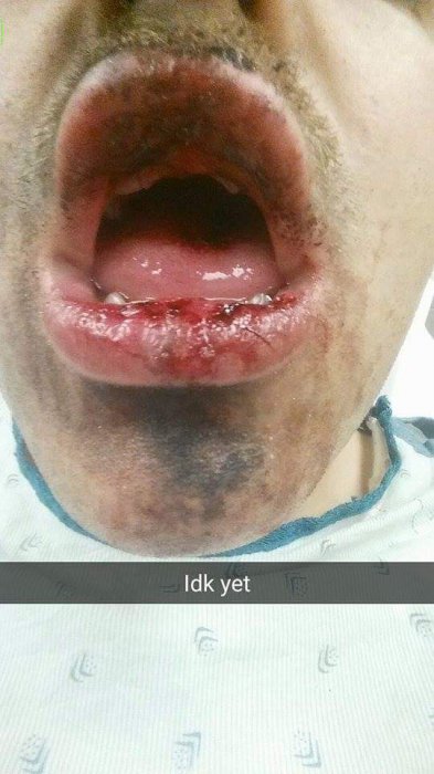 О вреде электронных сигарет