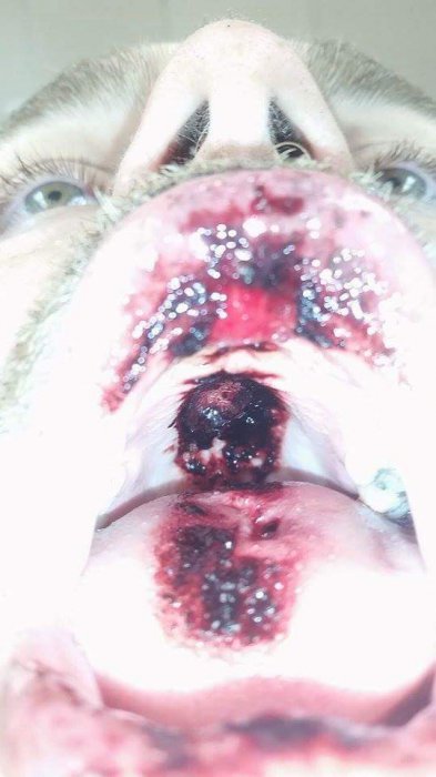 О вреде электронных сигарет