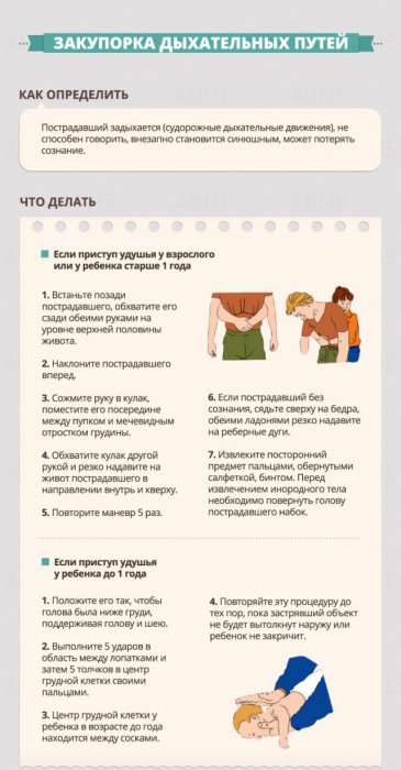 Инструкции по оказанию первой помощи