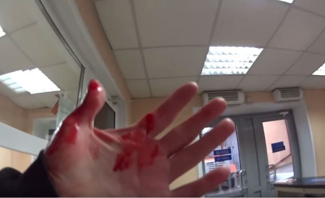 Звезду Рунета Бродягу Фишая избили дрелью в Красноярске