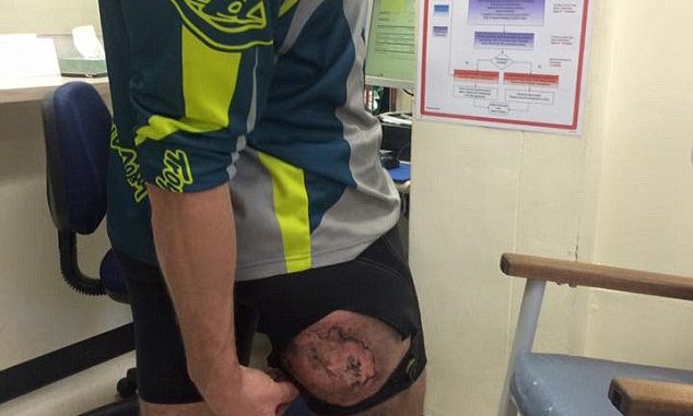 Очередной iPhone взорвался в кармане