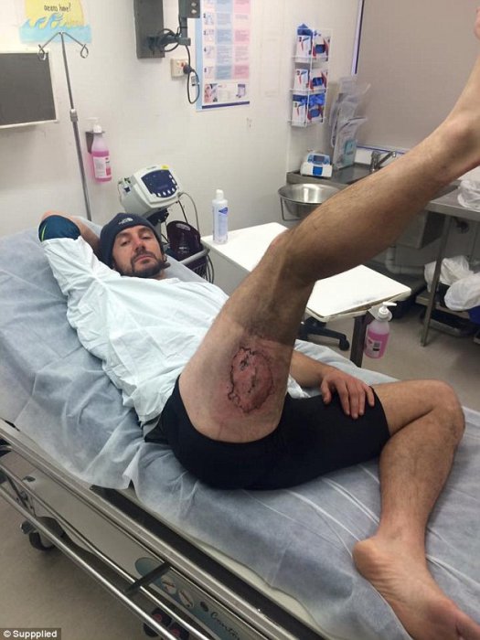 Очередной iPhone взорвался в кармане