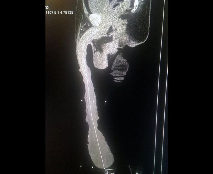 Самый большой пенис