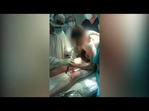  Прут арматуры прилетел в рот