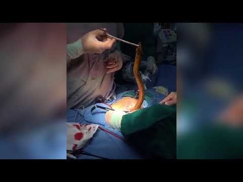 Уникальное видео: рождение угря