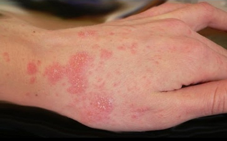 10 самых страшных паразитов, которые могут жить в человеческом теле 10 самых страшных паразитов, которые могут жить в человеческом теле