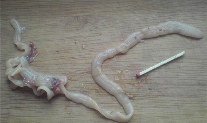 10 самых страшных паразитов, которые могут жить в человеческом теле 10 самых страшных паразитов, которые могут жить в человеческом теле