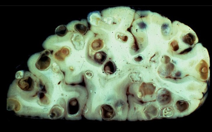 10 самых страшных паразитов, которые могут жить в человеческом теле 10 самых страшных паразитов, которые могут жить в человеческом теле