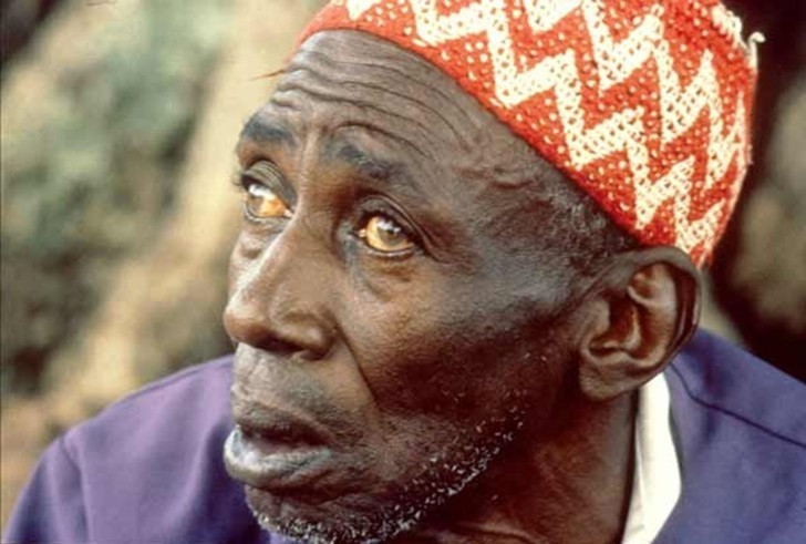 10 самых страшных паразитов, которые могут жить в человеческом теле 10 самых страшных паразитов, которые могут жить в человеческом теле