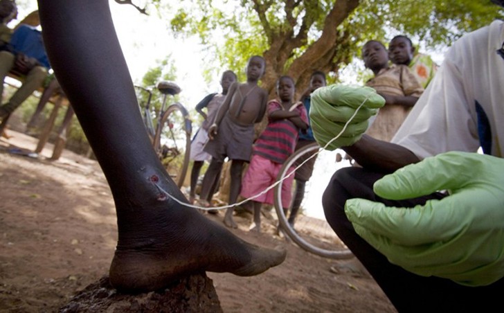 10 самых страшных паразитов, которые могут жить в человеческом теле 10 самых страшных паразитов, которые могут жить в человеческом теле