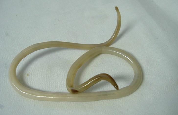 10 самых страшных паразитов, которые могут жить в человеческом теле 10 самых страшных паразитов, которые могут жить в человеческом теле