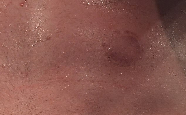 Британский боксер Кэш Али укусил Дэвида Прайса во время боя