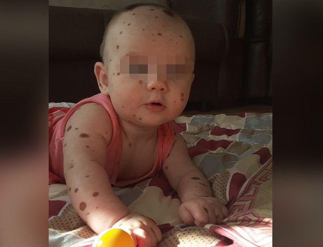 Курганский священник не захотел крестить ребенка из-за большого родимого пятна