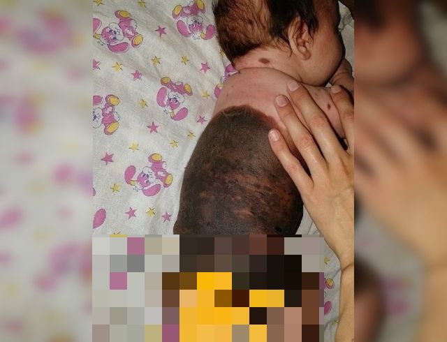 Курганский священник не захотел крестить ребенка из-за большого родимого пятна