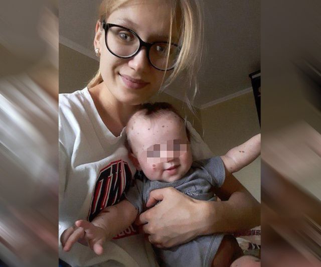 Курганский священник не захотел крестить ребенка из-за большого родимого пятна