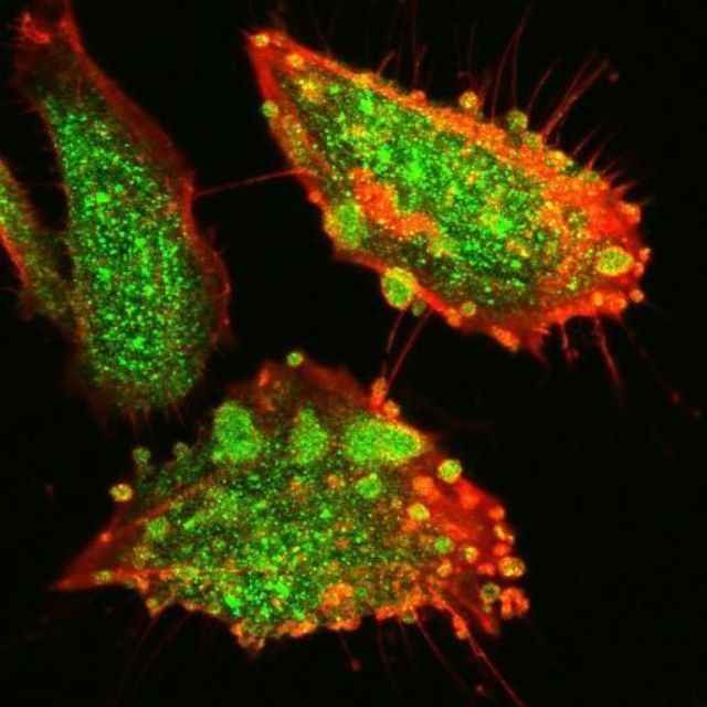 Эволюция человека еще продолжается (15 фото) Эволюция человека еще продолжается (15 фото)