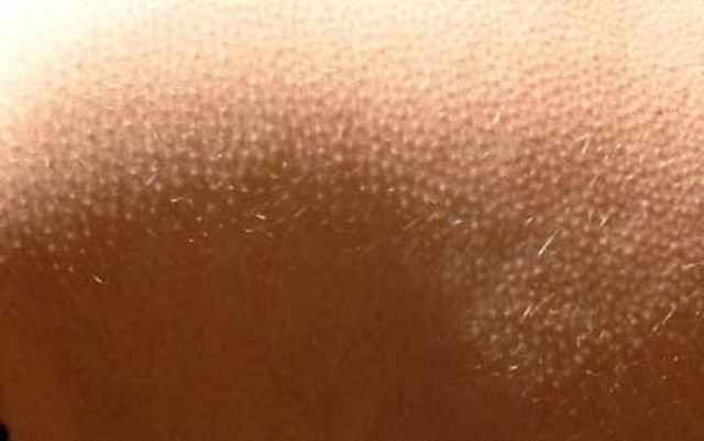 Эволюция человека еще продолжается (15 фото) Эволюция человека еще продолжается (15 фото)