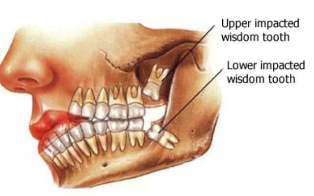 Эволюция человека еще продолжается (15 фото) Эволюция человека еще продолжается (15 фото)