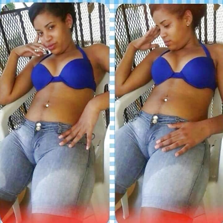 Верблюжья лапка