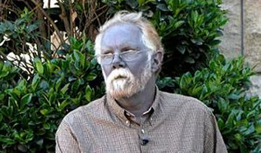 Люди с голубой кожей, правда или ложь?