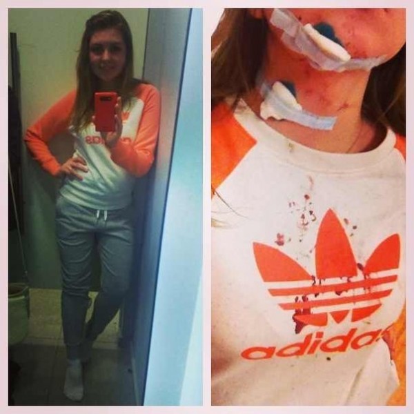 История Алины Новицкой (4 фото)