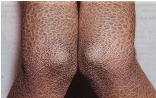 Люди с необычными способностями (13 фото)