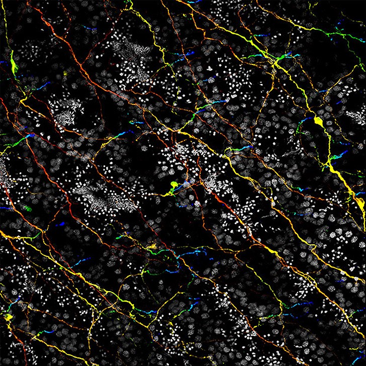 Лучшие фотографии с конкурса Nikon Small World Лучшие фотографии с конкурса Nikon Small World