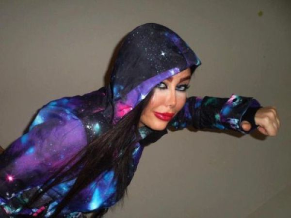 Жертвы пластической хирургии