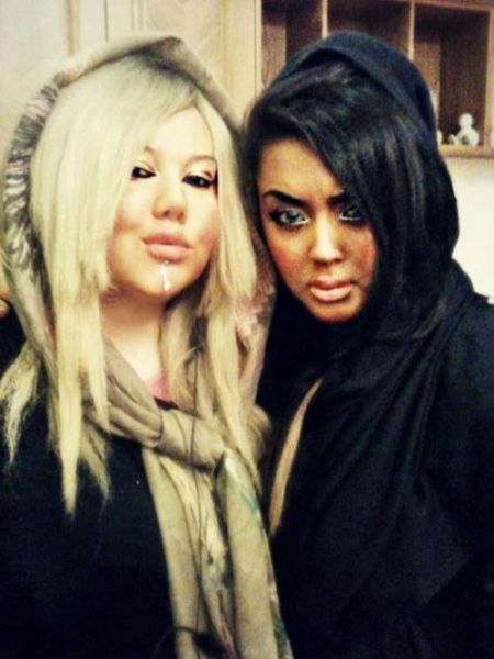 Жертвы пластической хирургии