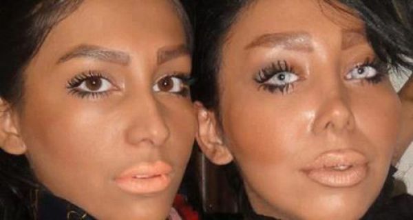 Жертвы пластической хирургии