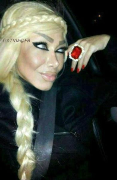 Жертвы пластической хирургии