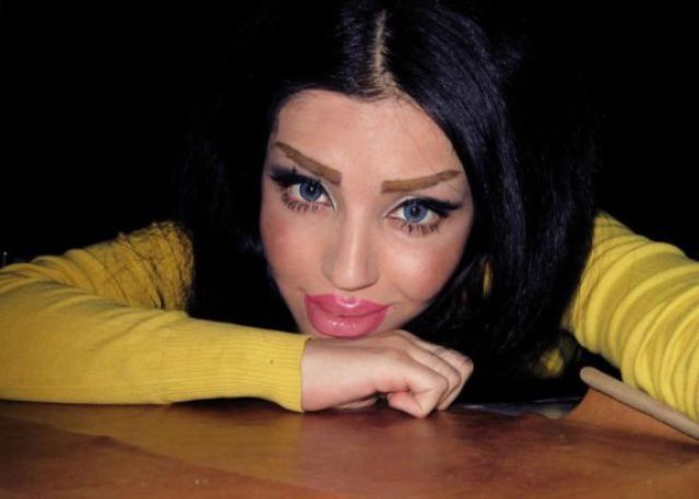 Жертвы пластической хирургии