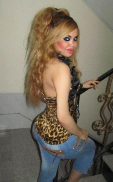 Жертвы пластической хирургии