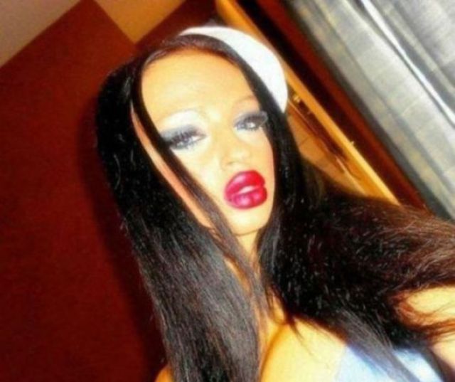 Жертвы пластической хирургии