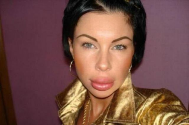 Жертвы пластической хирургии