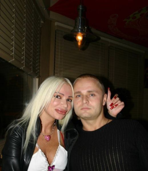 Жертвы пластической хирургии