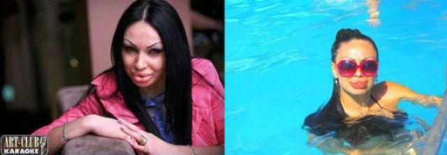 Жертвы пластической хирургии