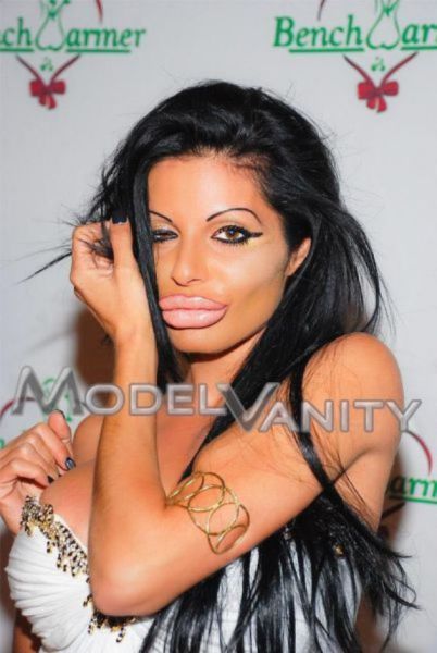 Жертвы пластической хирургии