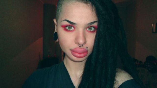 Жертвы пластической хирургии