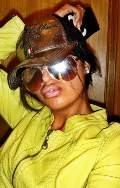 Жертвы пластической хирургии