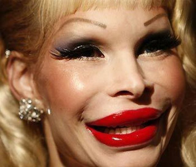 Жертвы пластической хирургии