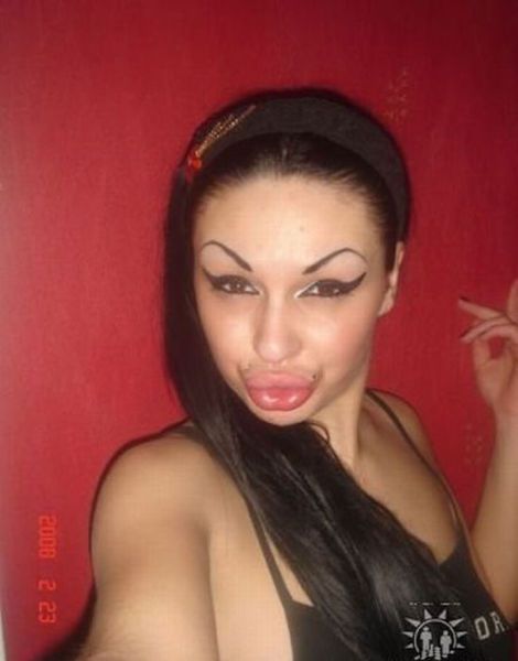 Жертвы пластической хирургии