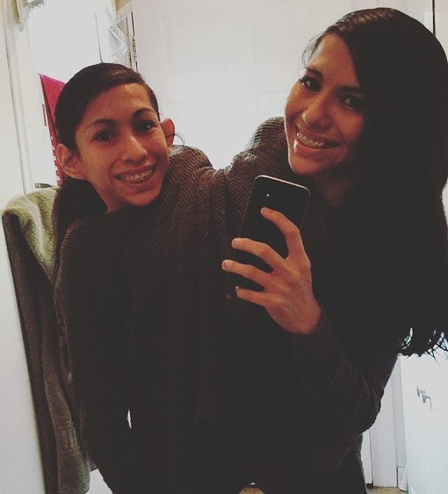 Лупита и Кармен Невероятная жизнь девочек-сиамских близнецов