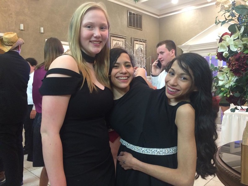 Лупита и Кармен Невероятная жизнь девочек-сиамских близнецов